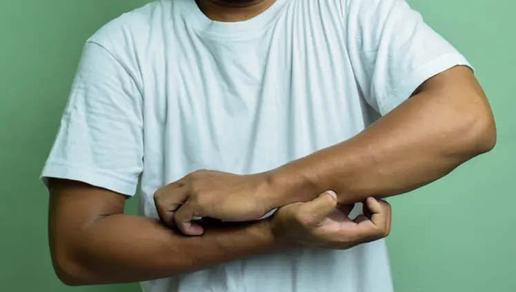 A man scratching his arms.